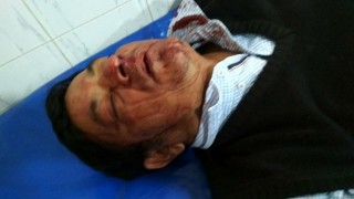 নরসিংদী-২ (পলাশ): হামলায় মঈন খানের ব্যক্তিগত সহকারী আহত