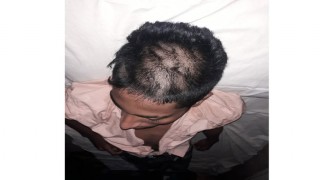 বেলাবতে শিক্ষক কর্তৃক মাথার চুল কেটে নেয়ার লজ্জায় ছাত্রের আত্মহত্যার চেষ্টা বেলাবতে শিক্ষক কর্তৃক মাথার চুল কেটে নেয়ার লজ্জায় ছাত্রের আত্মহত্যার চেষ্টা