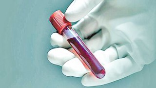 মৃত্যুর দিনক্ষণ জানা যাবে রক্ত পরীক্ষা করে!!!