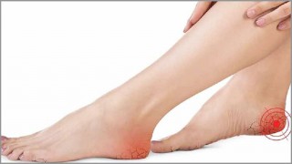 পায়ের গোড়ালি ফেটে গেলে করণীয়