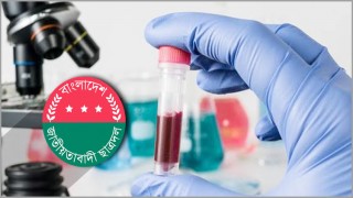 ডোপ টেস্টের মাধ্যমে ছাত্রদলের নেতৃত্ব নির্বাচনের চিন্তা