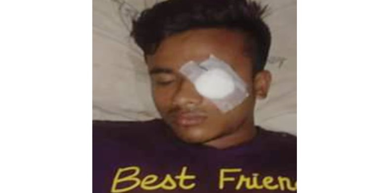 বেলাবতে অধ্যক্ষের বিরুদ্ধে শিক্ষার্থীকে পিটিয়ে আহত করার অভিযোগ বেলাবতে অধ্যক্ষের বিরুদ্ধে শিক্ষার্থীকে পিটিয়ে আহত করার অভিযোগ
