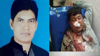 রায়পুরায় সাংবাদিকের উপর হামলা: ইউপি চেয়ারম্যান নাসিরসহ ২০ জনের বিরুদ্ধে মামলা