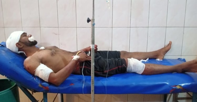 হাজীপুরে মাদক বিক্রিতে বাঁধা দেয়ায় তিনজনকে কুপিয়ে আহত হাজীপুরে মাদক বিক্রিতে বাঁধা দেয়ায় তিনজনকে কুপিয়ে আহত