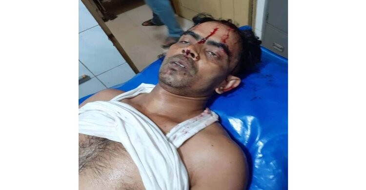 শিবপুরে সন্ত্রাসী হামলায় আইনজীবী আহত শিবপুরে সন্ত্রাসী হামলায় আইনজীবী আহত