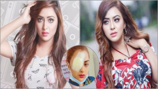 কন্টাক্ট লেন্স গলে চোখের সমস্যায় চিত্রনায়িকা তানহা