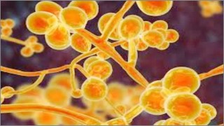 ভারতে এবার ধরা পড়েছে 'ইয়েলো ফ্যাঙ্গাসে'র সংক্রমণ! ভারতে এবার ধরা পড়েছে 'ইয়েলো ফ্যাঙ্গাসে'র সংক্রমণ!