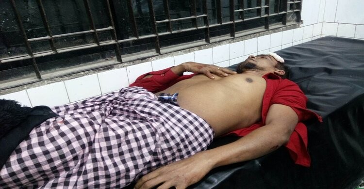 নরসিংদীতে অবৈধভাবে মসজিদের জমি দখলে বাধা দেয়ায় দোকানীকে কুপিয়ে আহত নরসিংদীতে অবৈধভাবে মসজিদের জমি দখলে বাধা দেয়ায় দোকানীকে কুপিয়ে আহত