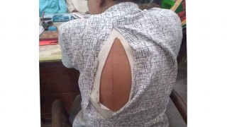 বেলাবতে কলেজে যাবার পথে শিক্ষককে ছুরিকাঘাত