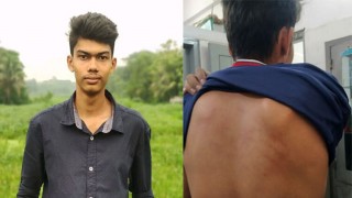 পলাশে সংবাদকর্মীকে ডেকে নিয়ে বেধড়ক পেটালেন কাউন্সিলর