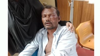 মাধবদীতে জুট ব্যবসা নিয়ে বিএনপির দুই গ্রুপের সংঘর্ষ, আহত ৩